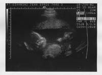Samuel's Ultrasound Photos